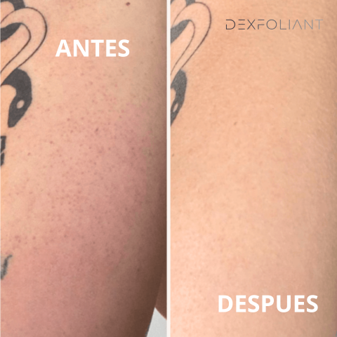 Dexfoliant™ Guante exfoliante profundo